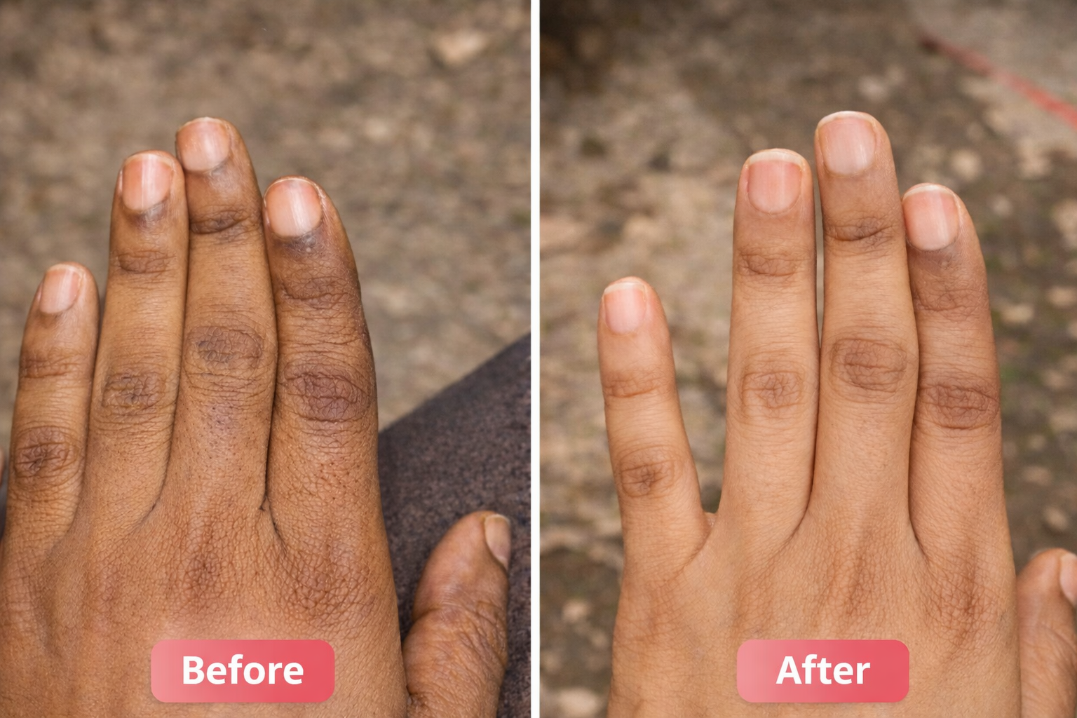 Dark Spot Serum for Normal Skin